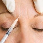 Botox injection to the forehead in dubai