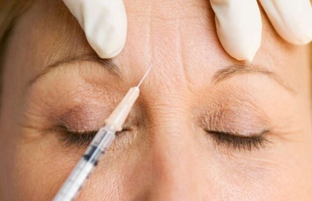 Botox injection to the forehead in dubai