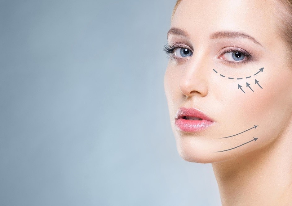 Endolift is used for which parts of the face