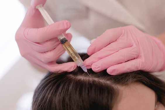 hair mesotherapy
