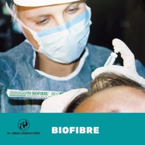 biofibre hair transplant