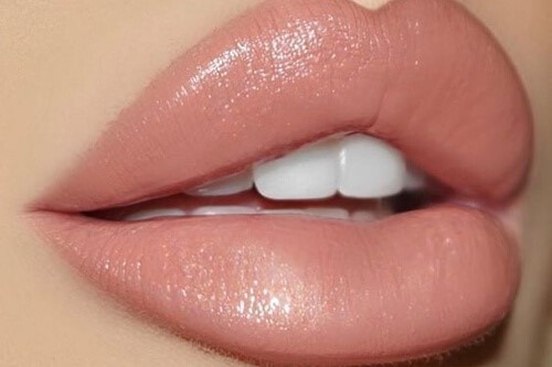What is russian lip Filler