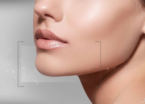 The effect of jawline fillers on facial beauty